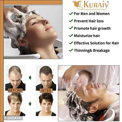 Kuraiy Natural Fenugreek Shampoo For Scalp Cleansing  Hair Fall Control Hair Growth Shampoo 200ml-thumb2