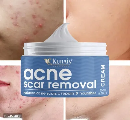 KURAIY Natural Effective Freckle Cream Remove Dark Spots Whitening Melanin Corrector Treat Acne Scars Brighten Lightening Cream