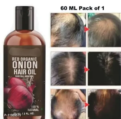 Super Onion Oil for Fast Hair Regrowth  Stopping Hair Fall Oil-60ml-