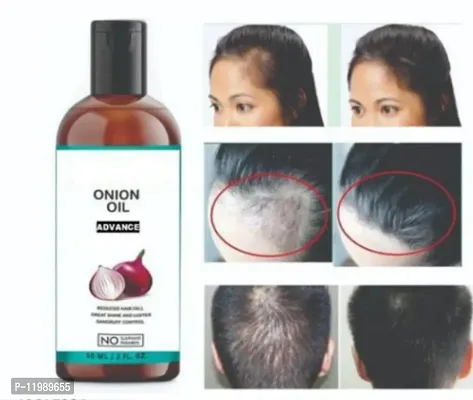 Great Onion Oil for Fast Hair Regrowth  Stopping Hair Fall Oil-60ml-
