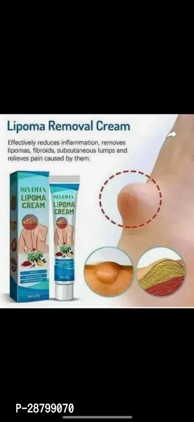 Lipoma Removal Cream- 50 Grams-thumb0