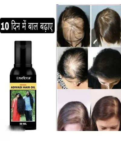 Adivasi Hair Oil For All Hair Types