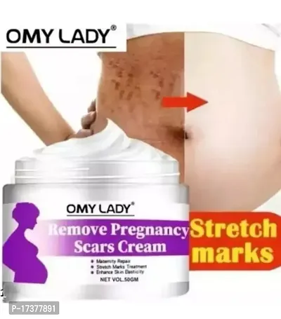 Remove pregnancy scars cream (pack of 1)