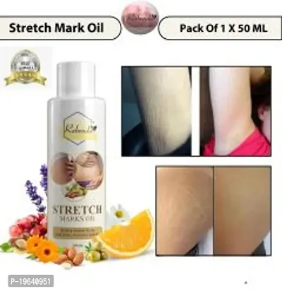 omy lady strech marks oil 50ml (pack of 1)-thumb0