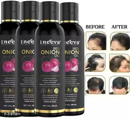 Eneeva Red Onion Hair Oil-100ml (Pack of 4)-thumb0