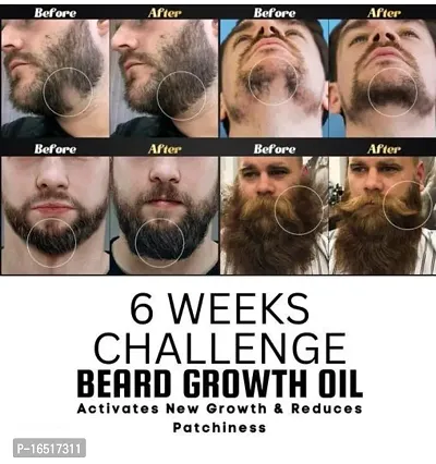 Faster Beard Growth and Thicker looking beard Hair Oil (50 ml)-thumb3