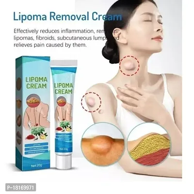 Lipoma Remover Cream Painless Herbal Lipolysis Fat Relief Remover Cream-thumb0