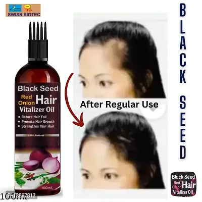 Swiss Black Seed Onion  Hair  Oil | Hair  Growth Oil| Reduces  Hair  fall | with Natural Coconut Oil, Onion Extracts, Vitamin E-thumb0