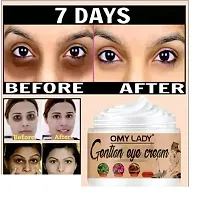 OMY LADY 7 DAYS Dark Circle removal Cream.-thumb1