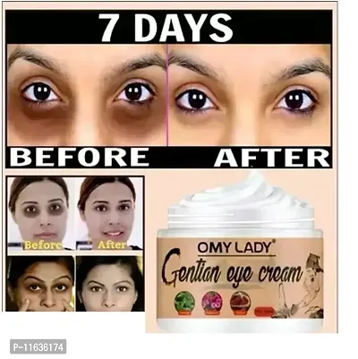 OMY LADY 7 DAYS Dark Circle removal Cream.-thumb2