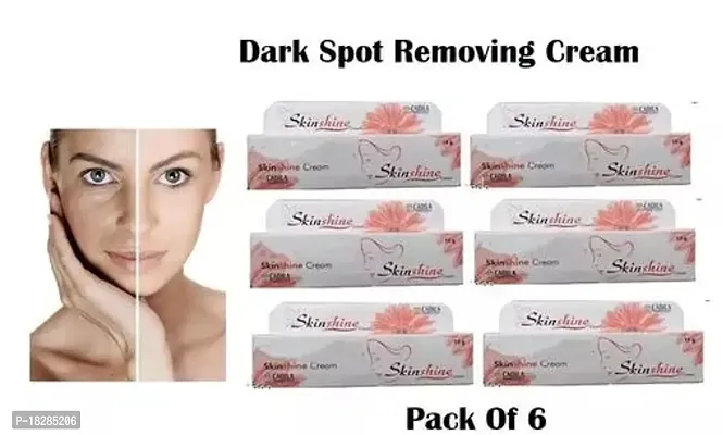 Skinshine Fairness Cream 15gm Each  (Pack Of 6)-thumb0