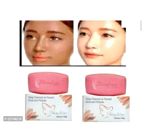 Skinshine Fairness Soap For Whiteing Skin-thumb0