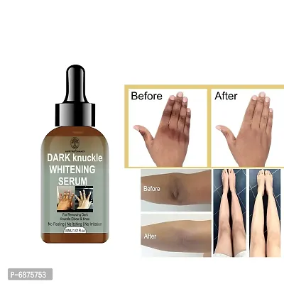 Whitening Serum Cleanserdark Spotsfor Removing Dark Spots Elbow And Knee Pack Of 1