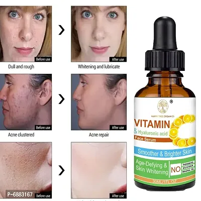 Mensonation Vitamin C Face Serum with 20% Vitamin C for Skin Brightening and Whitening