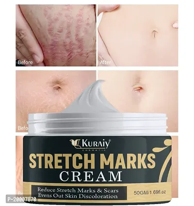 KURAIY Remove Pregnancy Scars Acne Cream Stretch Marks Treatment Maternity Repair Anti-Aging