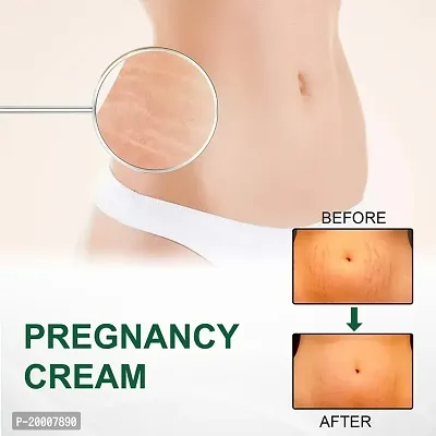 KURAIY Effective Remove Pregnancy Scars Acne Cream Stretch Mark Treatment Maternity Repair Anti-Aging-thumb3