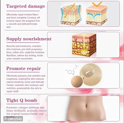 Kuraiy 100%  Repair Stretch Marks Removal - Natural Heal Pregnancy Breast, Hip, Legs-thumb3