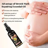 Kuraiy 100%  Repair Stretch Marks Removal - Natural Heal Pregnancy Breast, Hip, Legs-thumb1