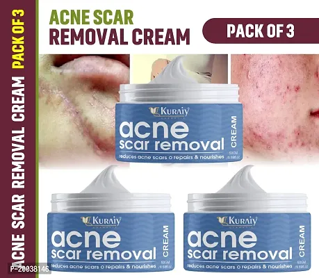 KURAIY Acne Face Cream Herbal Pimple Scar Removal Shrink Pore Oil Control Moisturizing Facial Cream Acne Pack of 3