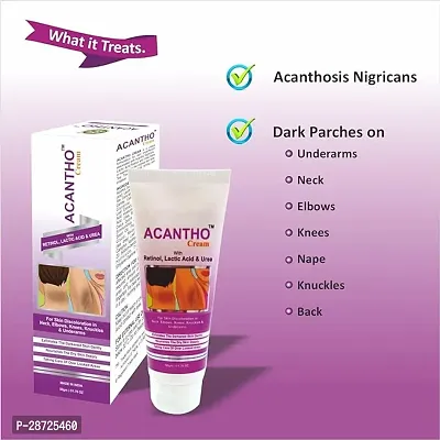 Acantho Cream With Retinol, Lactic Acid  Urea For Skin Discoloration-thumb2