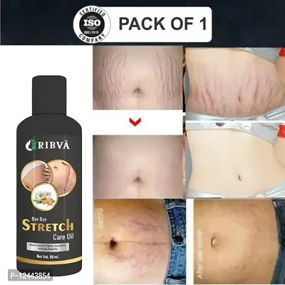 RIBVA present Stretch Marks Removal Oil - Natural Heal Pregnancy, Hip, Legs, Mark oil 50 ml pack of 1