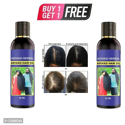 adivasi neelambari Premium quality of hair medicine for hair growth anti dandruff prevent hair fall 50 ml Hair Oil   50 ml) BUY 1 GET 1 FREE-thumb0