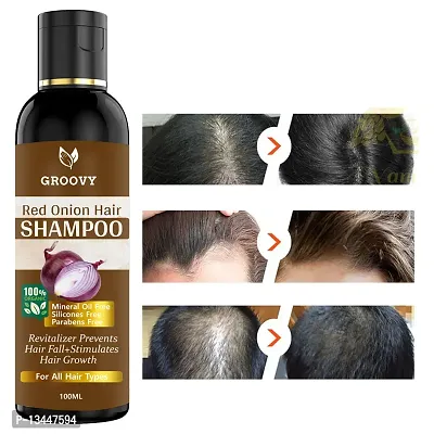 &nbsp;Ayurveda Onion Hair Shampoo For Hair Growth And Hair Fall Control With 14 Essential Oils Hair Shampoo 100 Ml)-thumb0