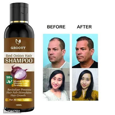 Onion Black Seed Hair Shampoo - With Comb Applicator - Controls Hair Fall And Regrowth Hair - No Mineral Oil, Silicones, Cooking Oil And Synthetic Fragrance Hair Shampoo 100Ml