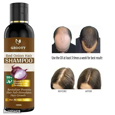 &nbsp;Onion Hair Shampoo - Black Seed Onion Hair Shampoo - Controls Hair Fall - For All Hair Problem Solution - No Mineral Oil, Colour, Sls, Peg For Men And Women (100 Ml) Hair Shampoo Ml)-thumb0