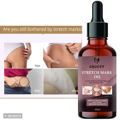 Soothing Scar and Stretch Mark Removal Oil | Pregnancy and Postpartum Safe | All-Natural, Paraben-Free  40 ml)