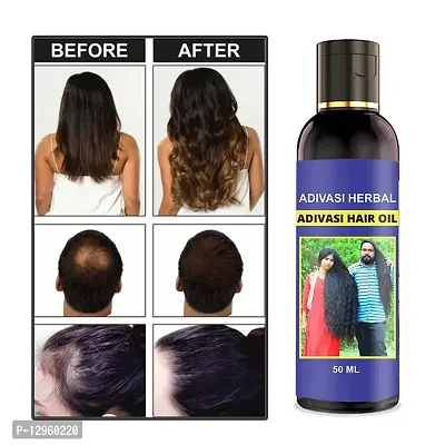 adivasi neelambari Kasturi Herbal Hair Oil for Hair Regrowth and Hair Fall Control Hair Oil   50 ml)-thumb0