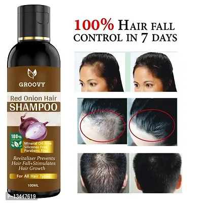 &nbsp;Red Onion Hair Shampoo&nbsp;Controls Hair Fall And Promotes Growth - Hair Oil 100Ml-thumb2
