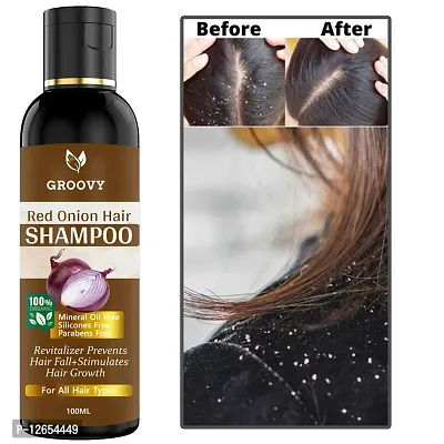 &nbsp;Advanced Hair Shampoo With Redensyl For Men Strengthens Hair And Improves Hair Health Hair Shampoo 100 Ml)-thumb0