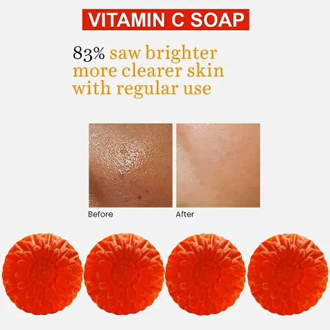 Vitamin C Soothing Soap With Chamomile Extract For Calm And Soothing Skin Multipack