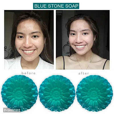 Blue Stone Soap: A Refreshing Start To Your Day Pack Of 3