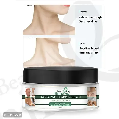 Neck Underarm Whitening Cream Removal of Hyperpigmentation - 50gm-thumb0