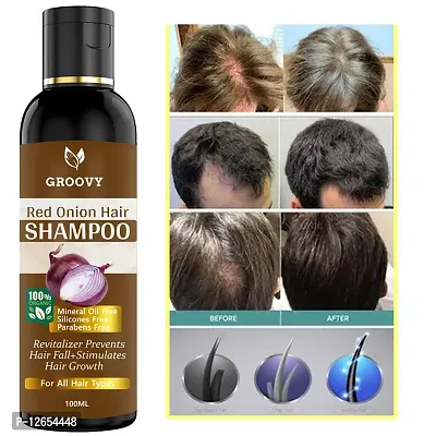 Red Onion Black Seed Shampoo -With Hair Shampoo 100 Ml)-thumb0