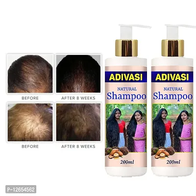 Adivasi Hair Regrowth And Hair Fall Control Hair Shampoo With Oil 200Ml With 100Ml Pack Of 2