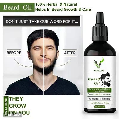 Essential Beard Oil For Man, Dadhi Badhane Ka Oil, nbsp;-thumb0