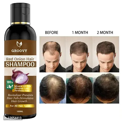 Onion Hair Shampoo For Long Hair, Hair Growth (Women And Men) Hair Shampoo 100 Ml)-thumb0