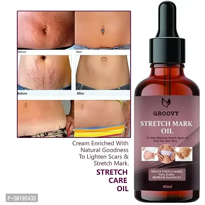 Stretch Mark Oil with the Goodness of Seabuckthorn Oil, Vitamin E and C, Lavender- 40ml-thumb0