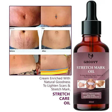 Groovy Stretch Mark Oil