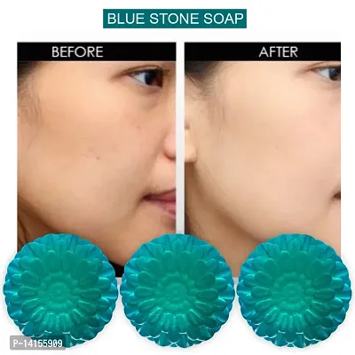 Blue Stone Soap - The Key To A More Confident And Beautiful You Pack Of 3-thumb0