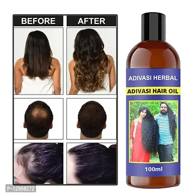 Adivasi Brungamalaka Herbal Hair Oil - 100% Natural / Organic Hair Growth Oil for Men and Womens Hair Oil   100 ml)-thumb0