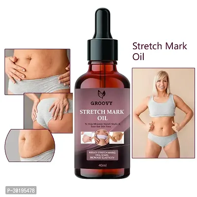 Repair Stretch Marks Removal Natural Heal Pregnancy Breast, Hip, Legs, Mark oil 40 ml pack of 1