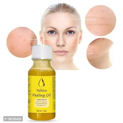 Yellow Peeling Oil Exfoliating Dark Skin for Body, the peeling solution 50 ml