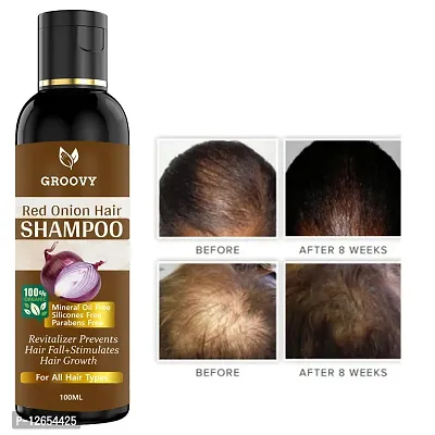 Red Onion Shampoo For Hair Regrowth Bio Active Hair Oil Nourshing Hair Treatment With Real Onion Extract Intensive Hair Fall Dandruff Treatment Each 100 Ml-thumb0