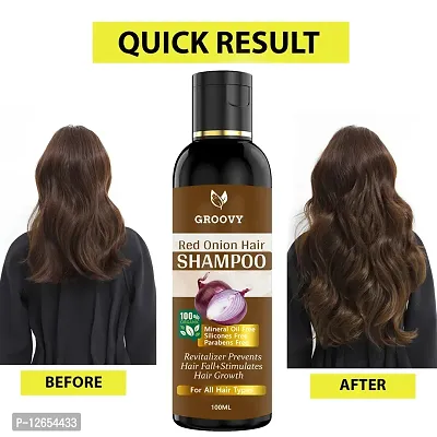 Hair Shampoo For Hair Fall And Regrowth, Women And Men Hair Shampoo 100 Ml)-thumb0
