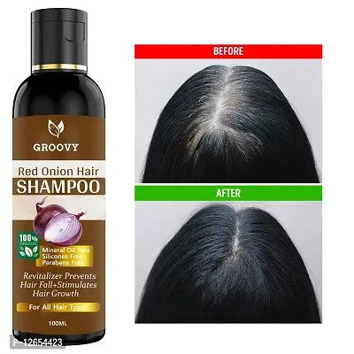 &nbsp;Onion Hair Shampoo With 14 Essential Oils, Onion Hair Oil For Hair Growth For Specially Men And Women Hair Shampoo 100 Ml)-thumb0