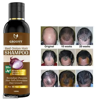 Onion Shampoo For Hair| Ayurvedic Bhringraj Onion Hair Shampoo | For Men Women|100 Ml Hair Shampoo 100 Ml)-thumb0